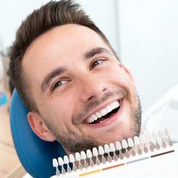 How Do Dental Veneers Stay on?