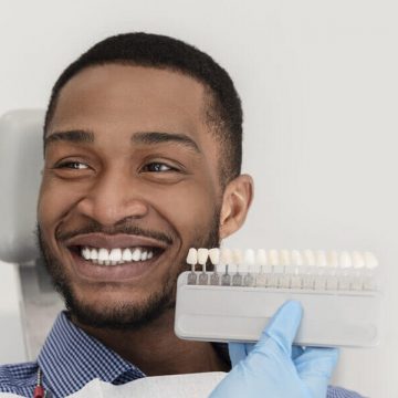 What Are Veneers? How Do Veneers Work?