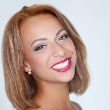 5 Reasons to Consider Dental Veneers