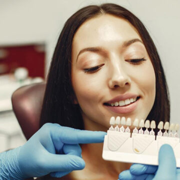 When Dental Veneers Are the Best Option for Your Smile Transformation